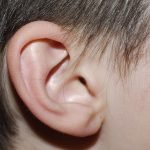 aparelho auditivo